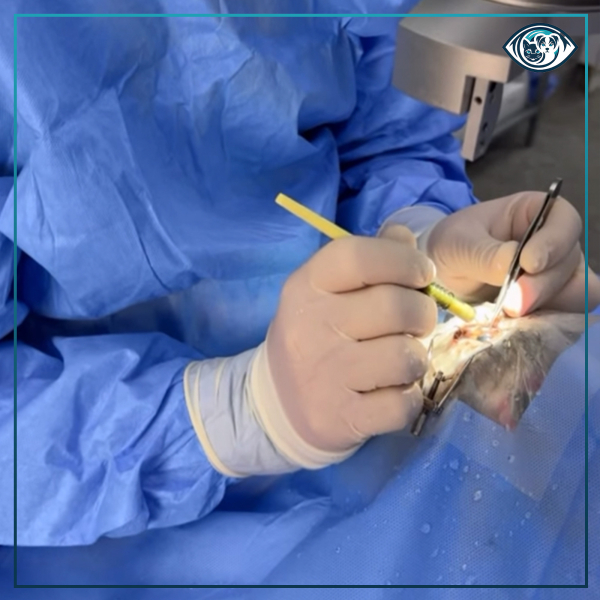 Trabekülektomi Ameliyatı Nedir?