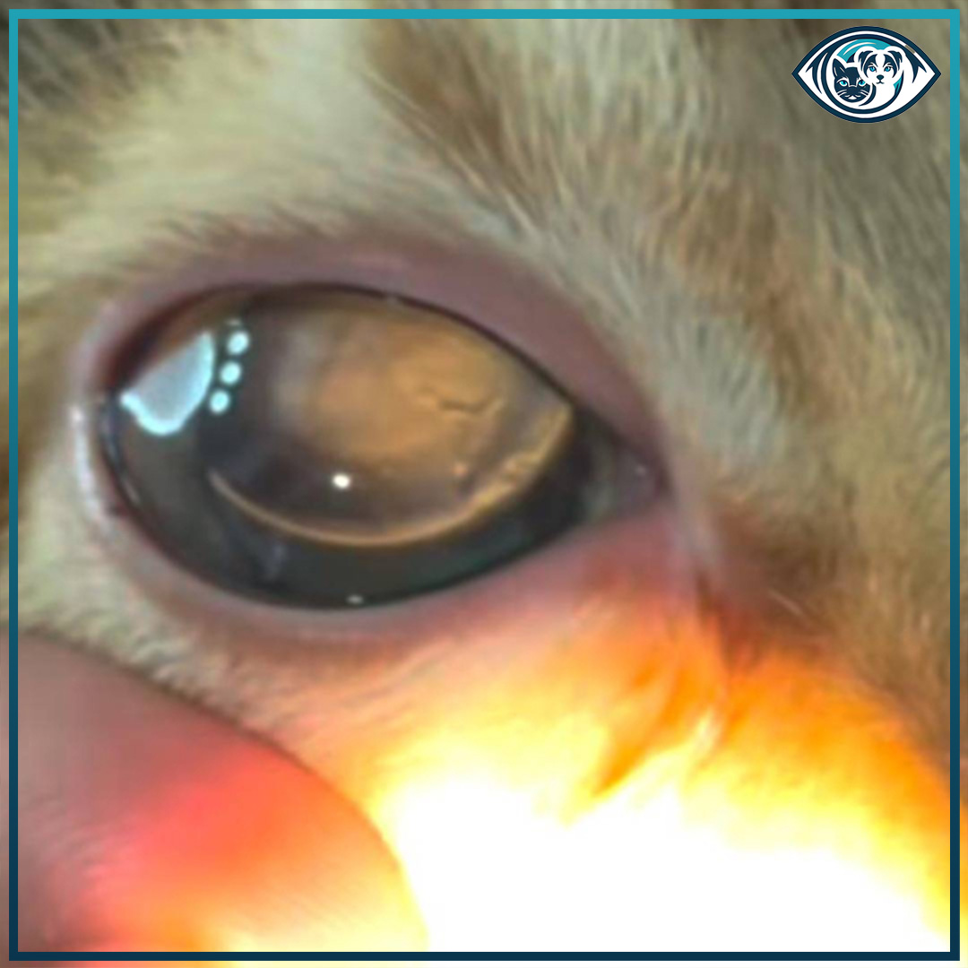 Kornea Nekrozu Nedir? Neden Ciddidir?